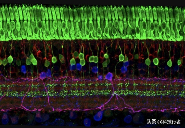 治疗视网膜色素变性的新研究成果,视网膜色素变性目前新型研究
