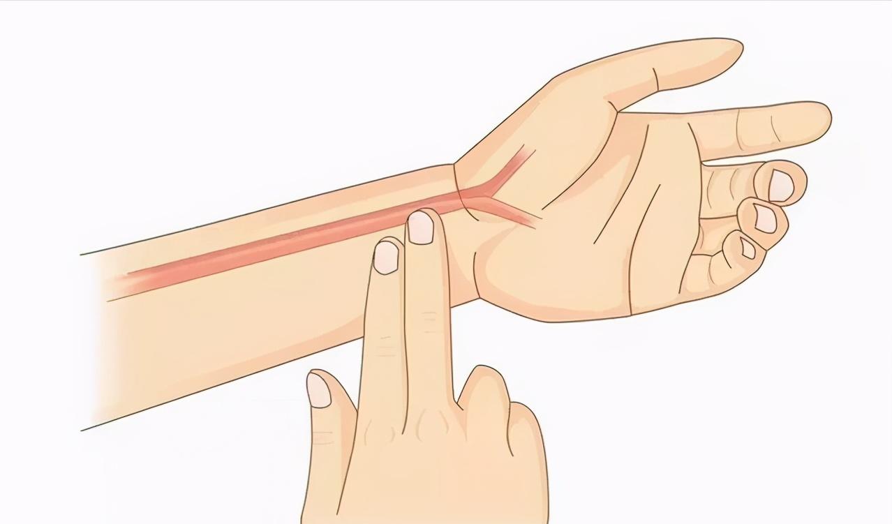 射频消融手术是怎样的,室上速射频消融术后如何护理