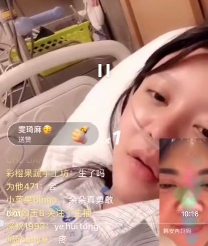 21岁韩安冉整容34次,21岁韩安冉整容35次