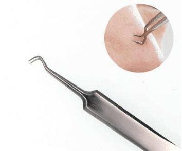 去白头的全部过程,去白头最好方法