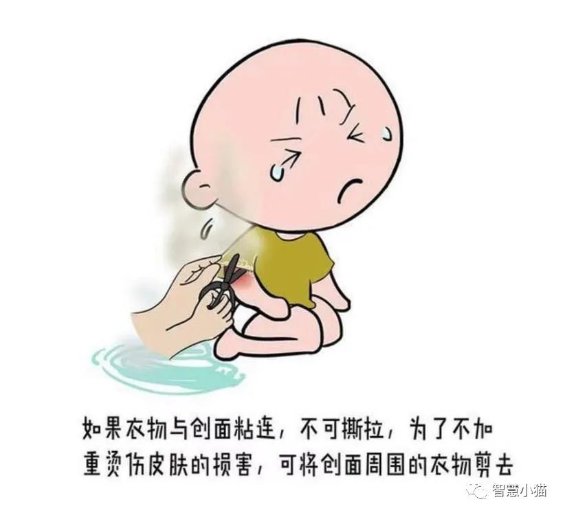 宝宝烫伤破皮露红肉了怎么护理,烫伤患者的护理问题及护理措施