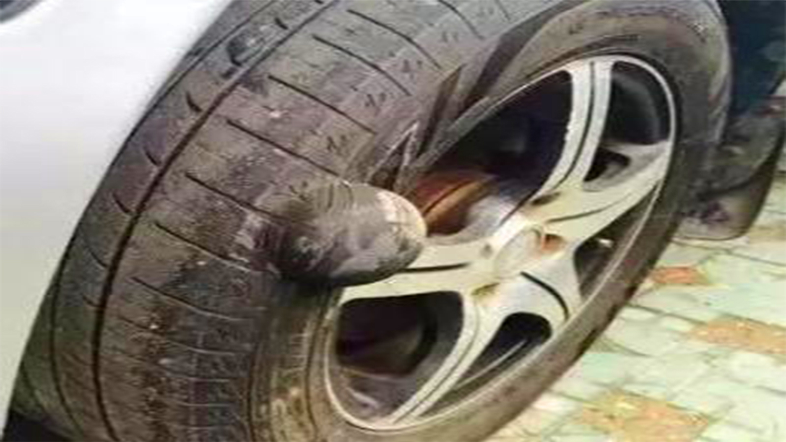 大便引发心源性猝死,大便导致心源性猝死