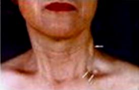 我不是药神，我不是财迷！若患胃癌，这些靶向药你有能力负担吗？