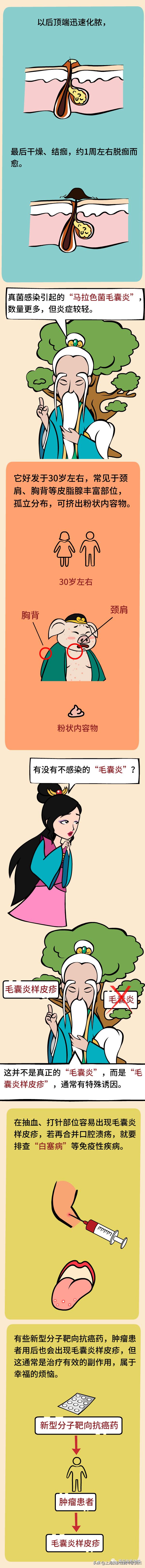 医道西游——喝凉茶去火治“红痘痘”（毛囊炎），靠谱吗？