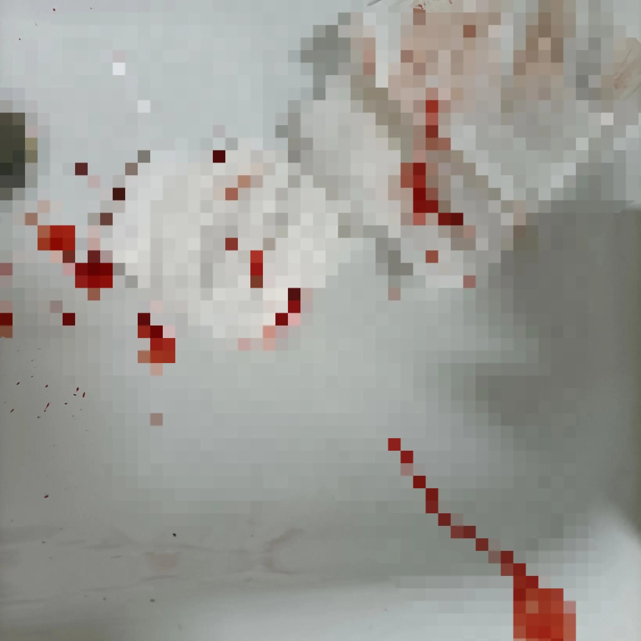 半夜摔倒头磕破了,晕倒导致头磕破出血了咋办