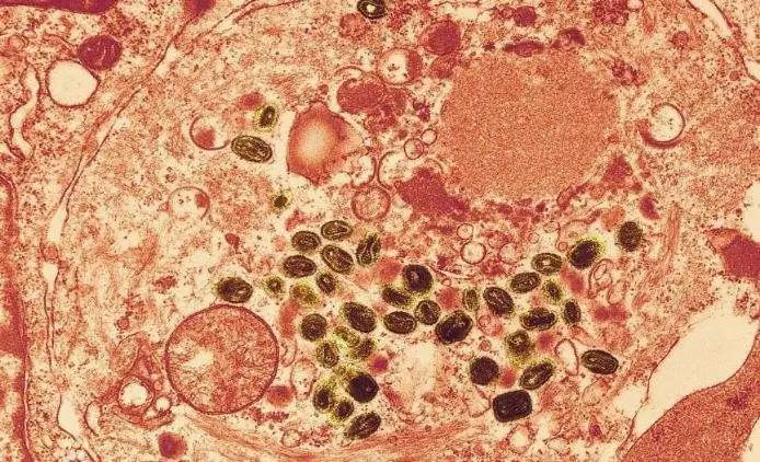 天花病毒如何干掉人类,天花病毒怎么意外消灭的