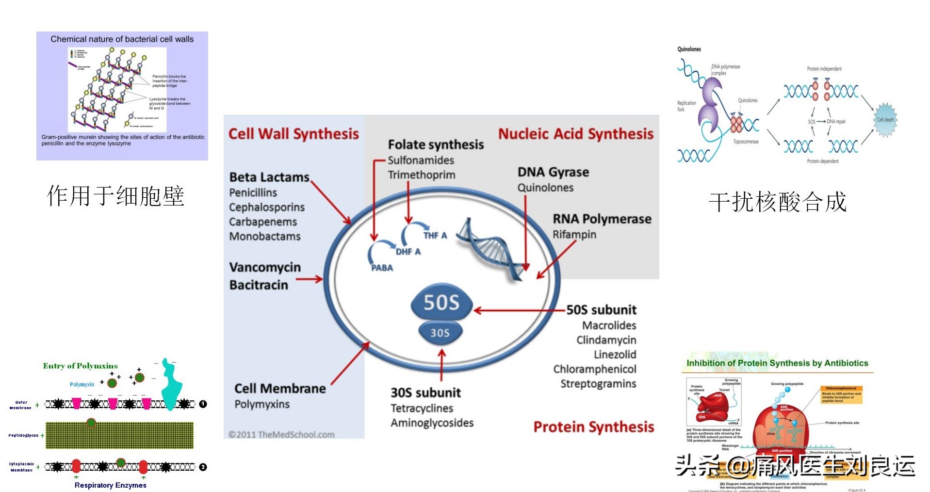 抗生素会引起痛风急性期发作吗,抗生素治风湿吗