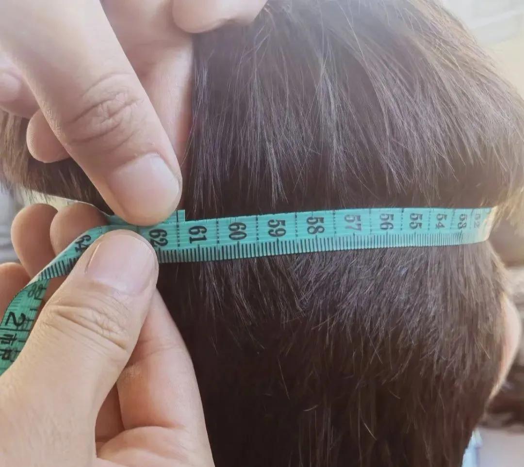 头大剪毁后需要很长时间补救,头大修复