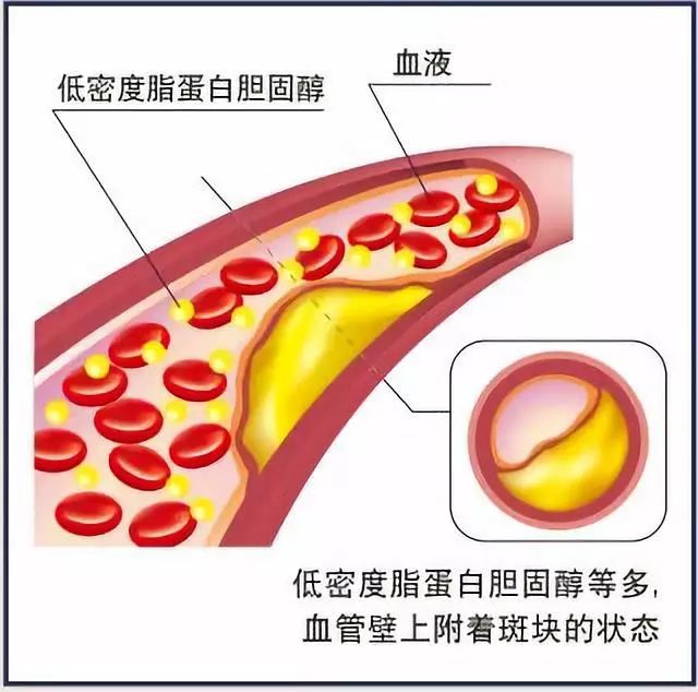 日本净化血液的最好方法 (日本最好的血液净化)