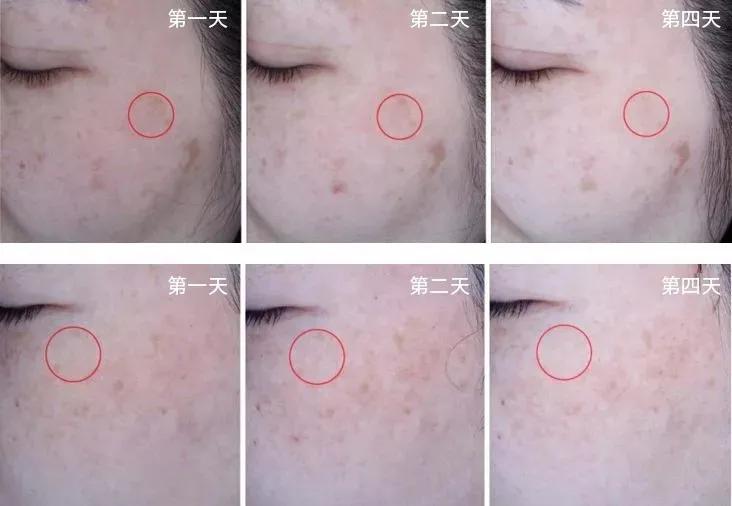 美白祛黄提亮肤色泡水喝,每天喝一杯可以美白淡斑清热解毒