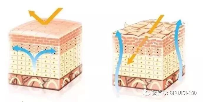 *褐斑黄**，你真正了解多少？碧芮斯带你真正了解“它”