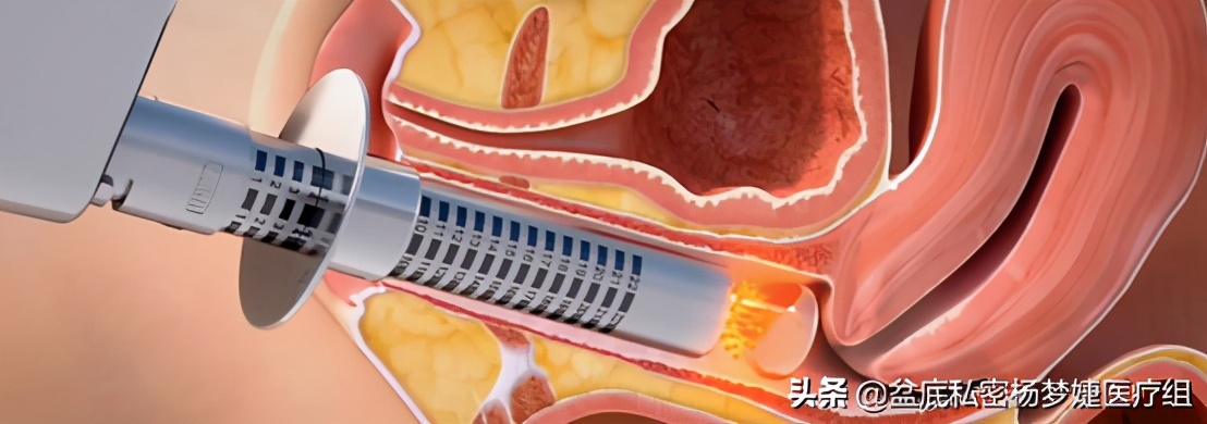 女性之声振聋发聩,女性之声余红梅