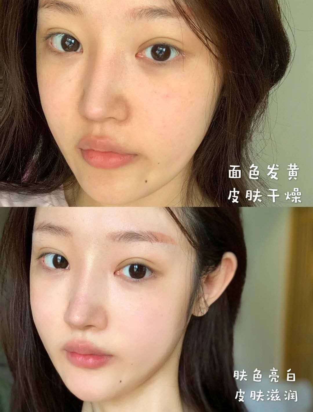 打美白针的明星,女明星打美白针没有副作用