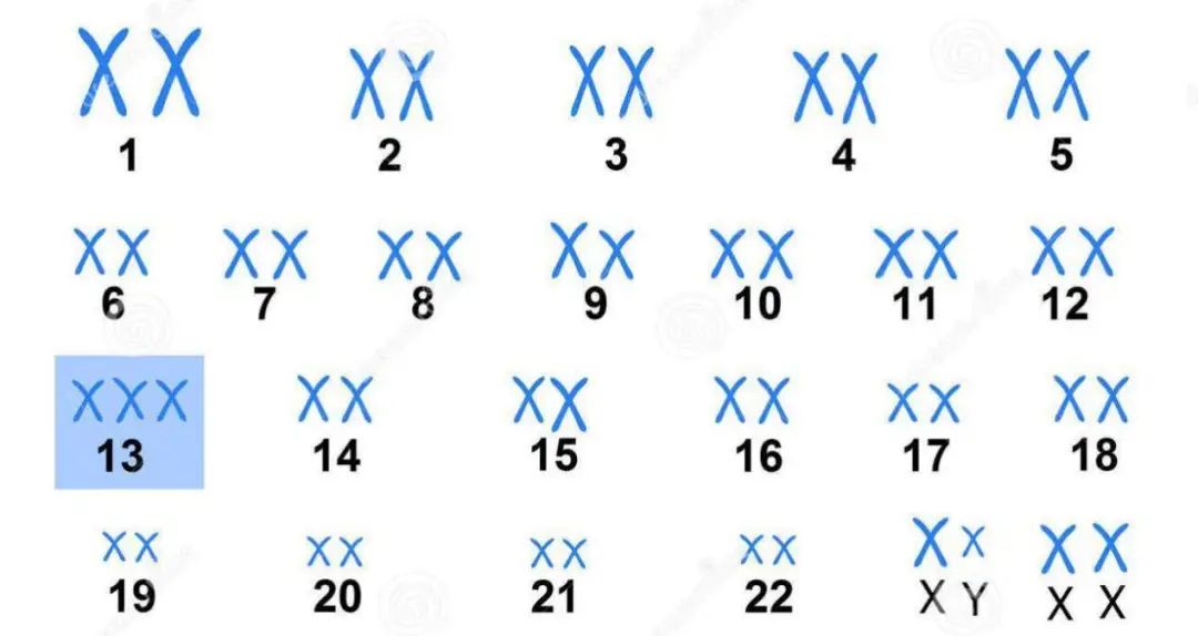 人类有两种人格吗,人类有两个性别吗