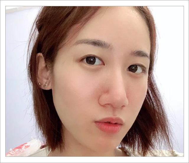 根除脸上螨虫的简单方法,螨虫在脸上如何彻底消除