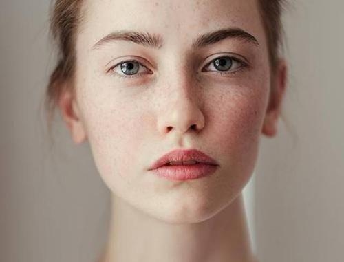 很年轻却有白头发怎么办,39岁毛发变白越来越多是什么原因