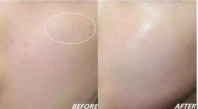 火到断货的“明星级”点斑笔,坚持每天点一下,14天养成初恋脸