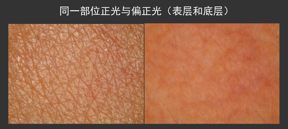 25-30岁美容仪测评,美容仪测评哪个好用