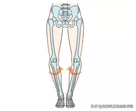 o型腿的赶紧看过来,o型腿有多丑