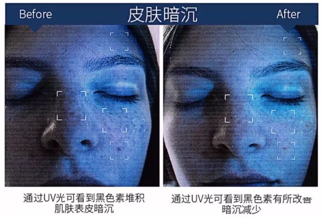 赵露思推荐补水保湿,赵露思推荐水感保湿焕颜面霜