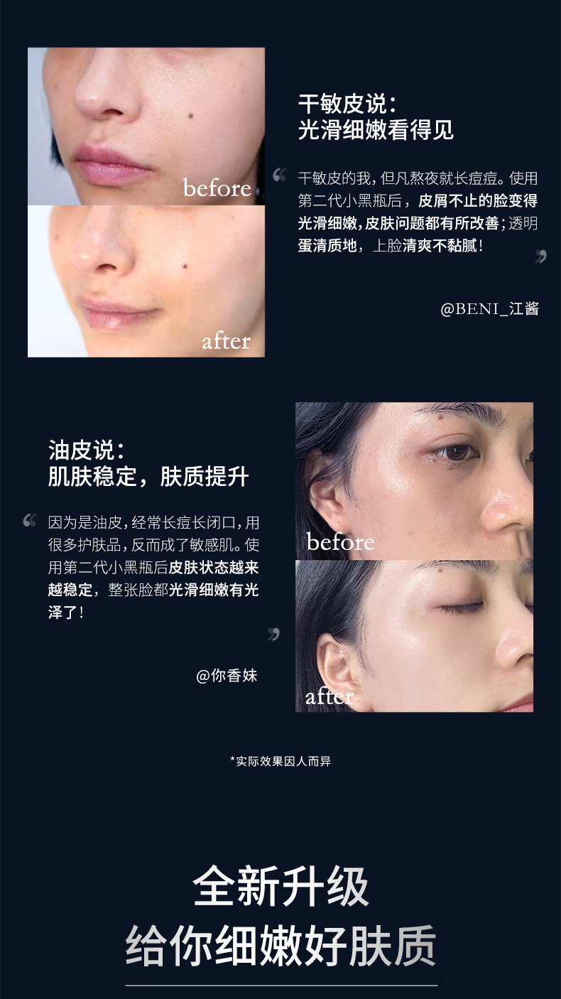 欧莱雅小黑瓶到底值不值得买,一百多三瓶欧莱雅黑精华