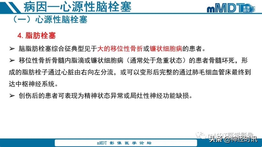 缺血性脑卒中护理课件,缺血性脑卒中讲课ppt