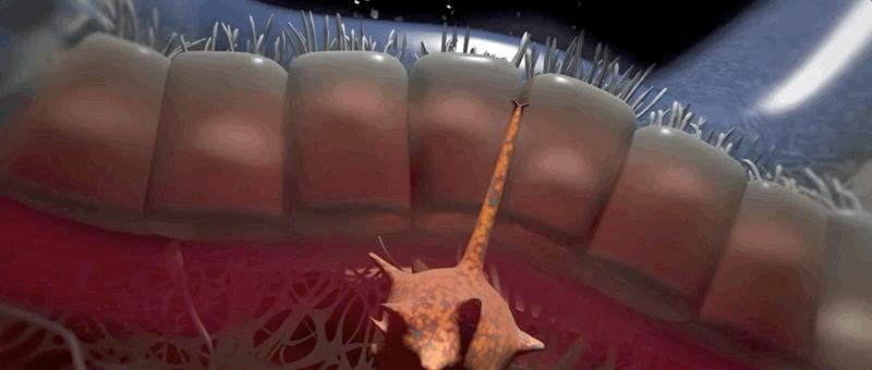 哮喘过敏症的症状,呼吸道过敏哮喘症状