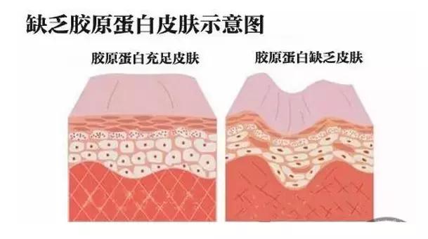 光子嫩肤和其他项目的区别,关于光子嫩肤的一些问题