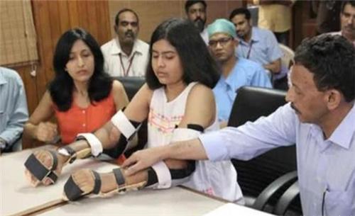 印度女孩因车祸失去双臂，谁知移植黑人手臂后，皮肤竟开始变黑