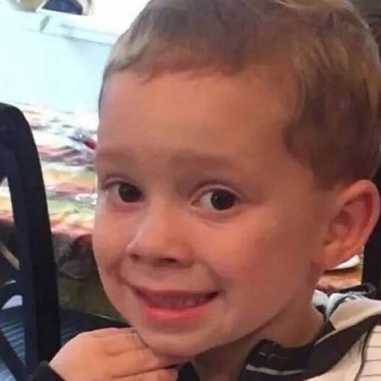 怎么保养皮肤这款护肤品你得知道,彻底改善皮肤需要多少套护肤品