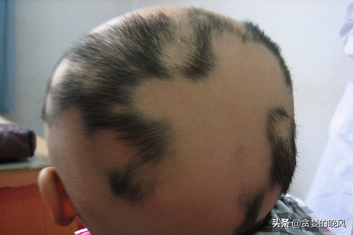 为什么草坪能频繁的修剪,老园丁养花从来不怕虫害