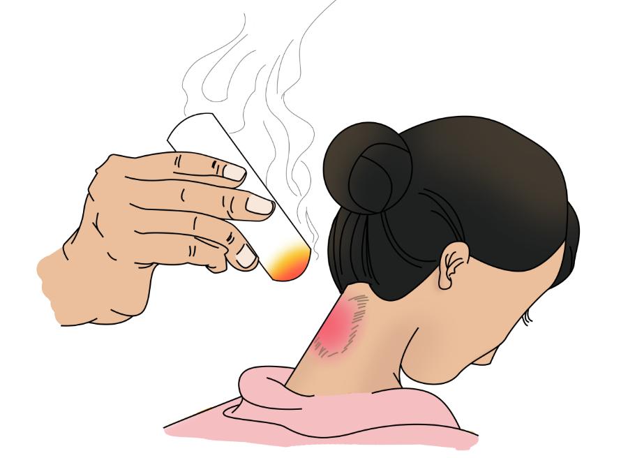 生气后按摩手上哪个穴位消气,身体有很多气怎么治疗