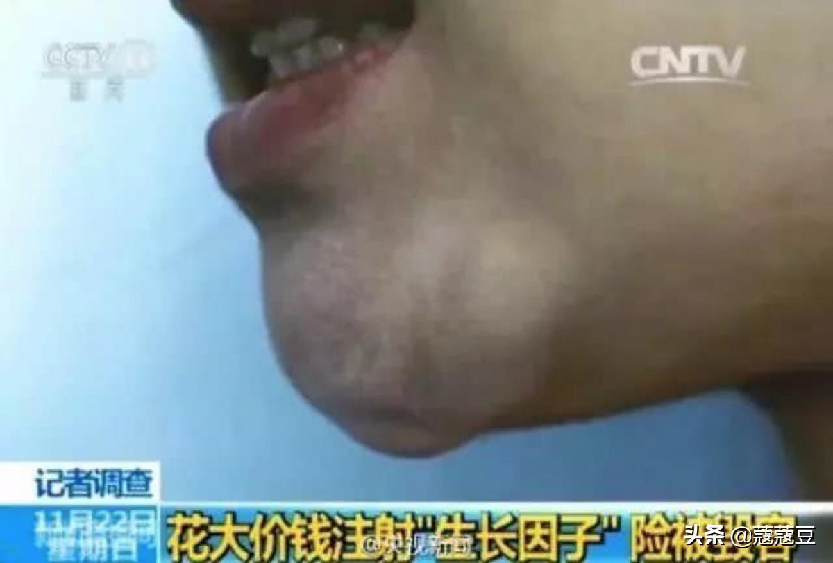 egf在护肤品中的作用与功效,egf加入护肤品有害处吗