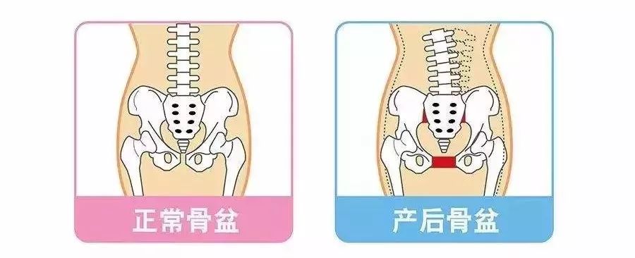 产后恢复千万别错过黄金,产后恢复这个黄金时间不要错过
