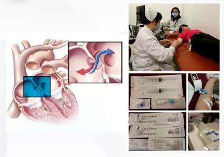 心脑血管微循环检测仪器,心脑血管检查仪