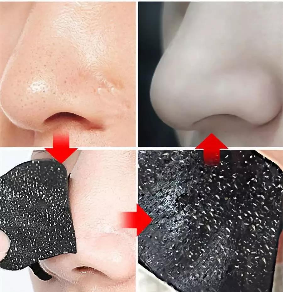 一秒去黑头去粉刺,一步就能搞定的黑头