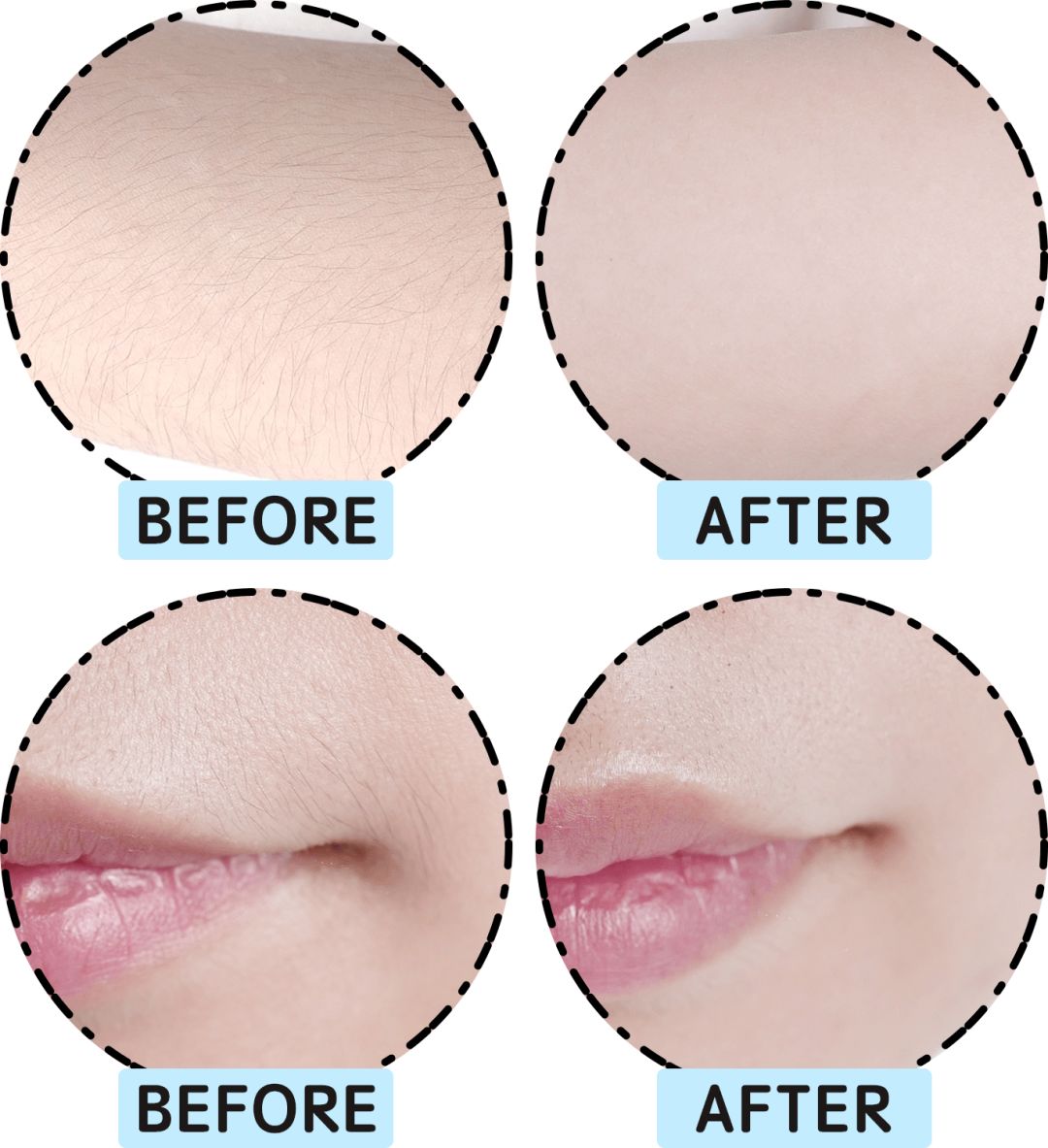 评测市面热销脱毛仪,jovs兰博基尼脱毛仪和ulike哪个好