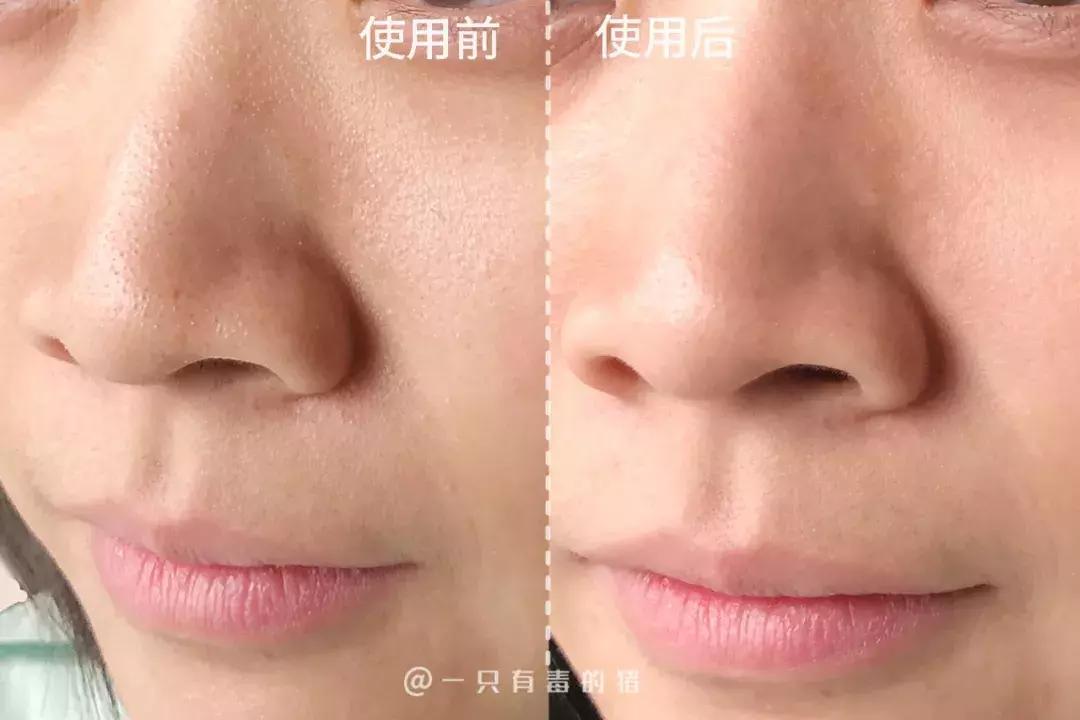 深层清洁面膜推荐网红,网红清洁面膜红黑榜