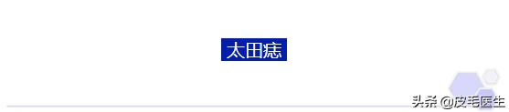 雀斑黄褐斑老年斑祛斑方法,褐斑老年斑怎么治疗效果最好