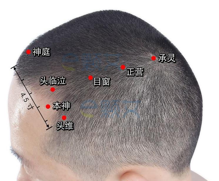 中风后该怎么恢复,中风后遗症做艾灸可以恢复吗