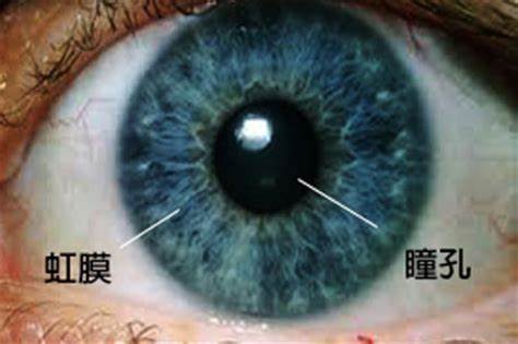 早期强直性脊柱炎会引起结膜炎吗,强直性脊柱炎会在春季得结膜炎吗