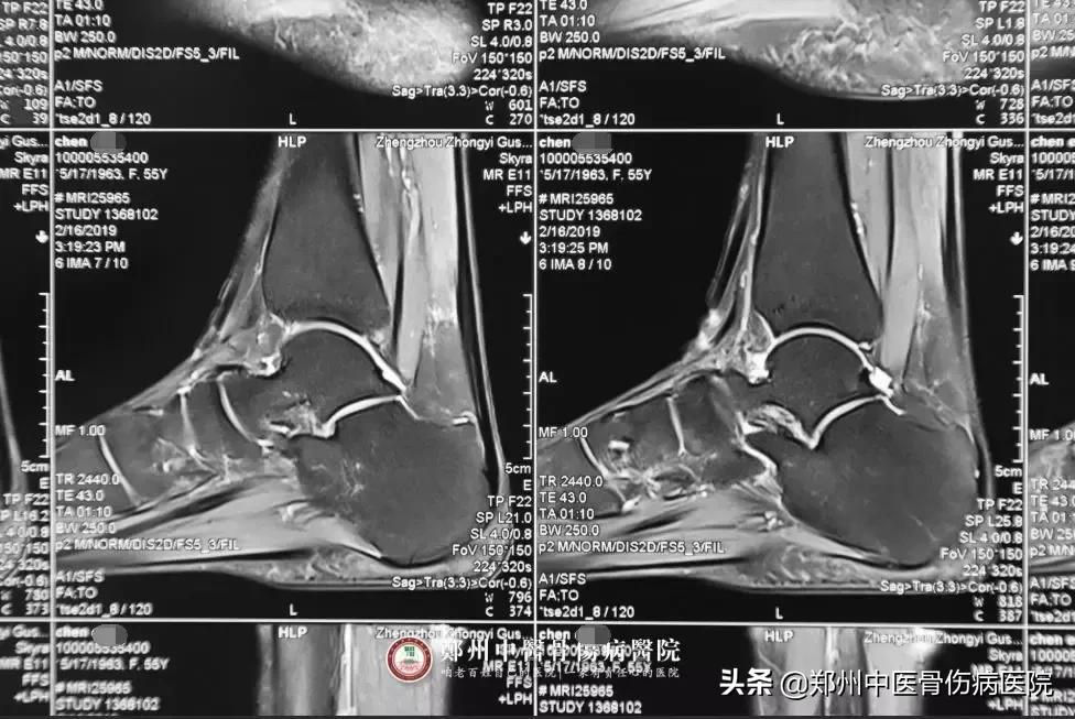 她辗转多家医院治疗未见好转,终在这里成功解除病痛!