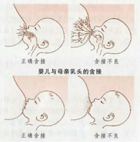 老婆生完娃乳房胀痛,老婆生第三胎反应很厉害怎么办