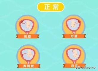 b超单显示后壁是前怀还是后怀,b超单上写了前壁是什么意思