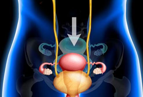 光动力治疗间质性膀胱炎,干细胞治疗间质性肾炎