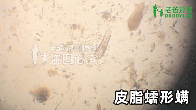 脸上发现蠕形螨虫,别人脸上的螨虫会爬到自己身上
