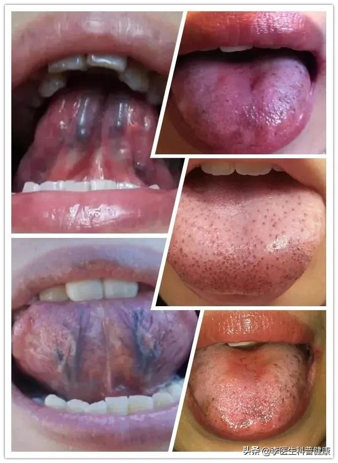 三七粉的八大禁忌是什么,天麻和三七粉泡水喝有什么禁忌