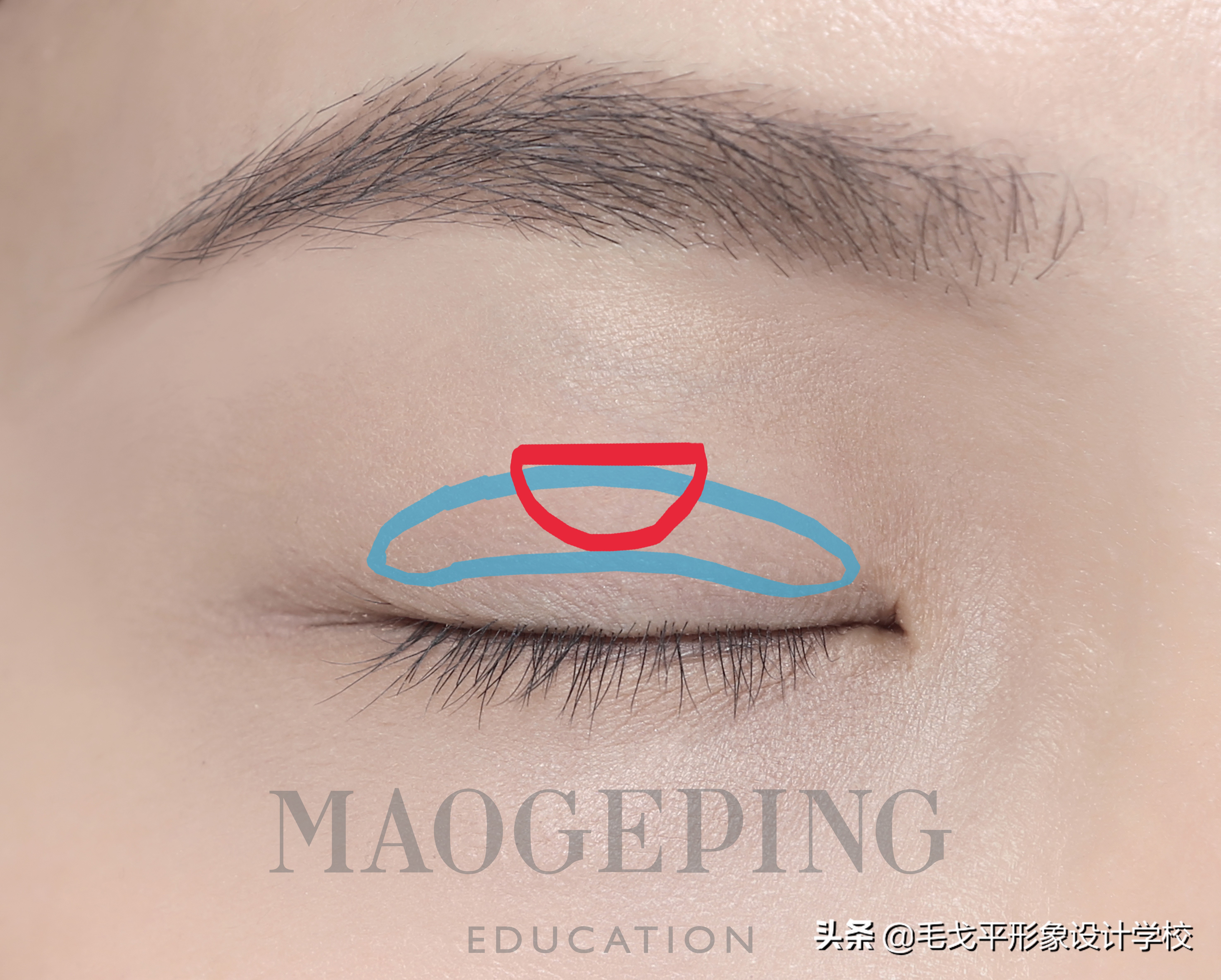 单眼皮肿眼泡正确贴法教程,单眼皮肿眼泡怎么贴双眼皮