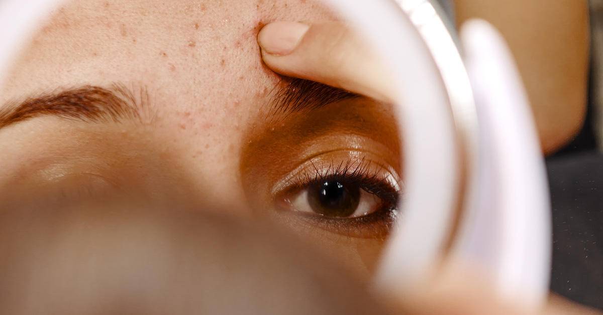 痘痘反反复复又红又疼又痒,痘痘反反复复有一层皮