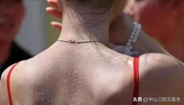 臭汗症是身体出汗哪里都臭吗,臭汗虚汗